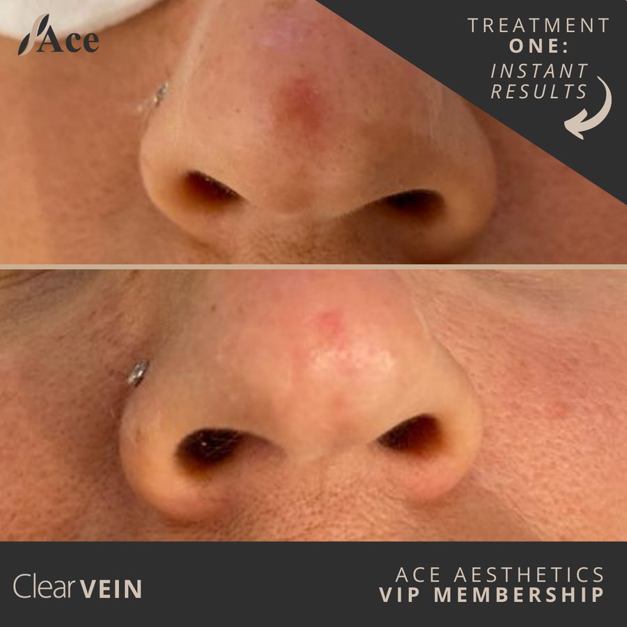 Ace Aesthetics - Ace Aesthetics